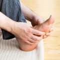 Expert Insights: Understanding the Recovery Time for Plantar Fasciitis