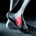 The Most Common Foot Injuries You Should Never Ignore