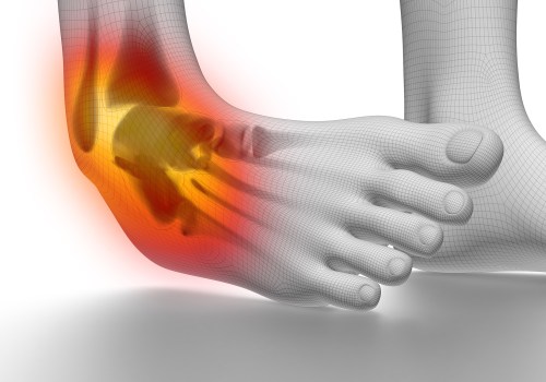 Understanding Foot and Ankle Injuries: An Expert's Perspective