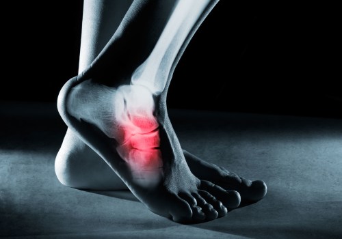 The Most Common Foot Injuries You Should Never Ignore